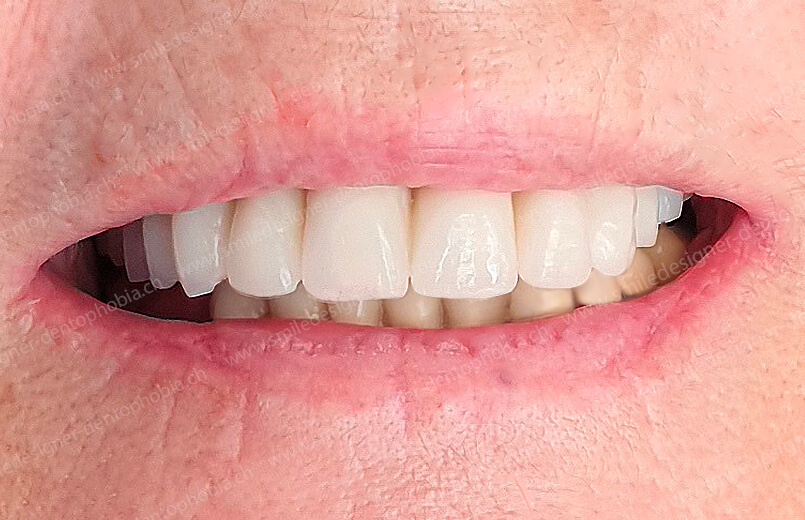 bridge-resilent-after-3