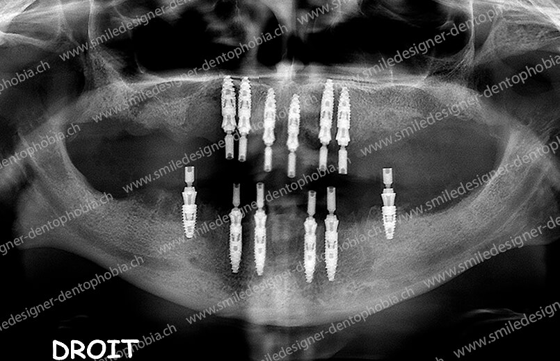 domino-radio-after-3