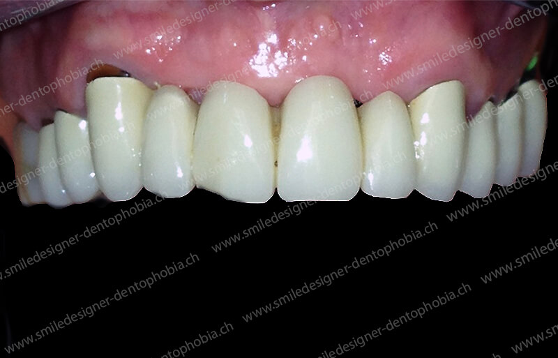 gold-damage-control-before-3