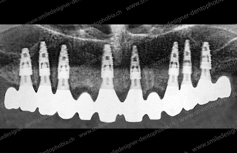 gold-damage-control-radio-after-4