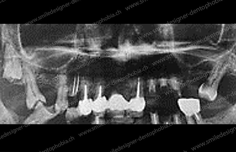 gold-damage-control-radio-before-4