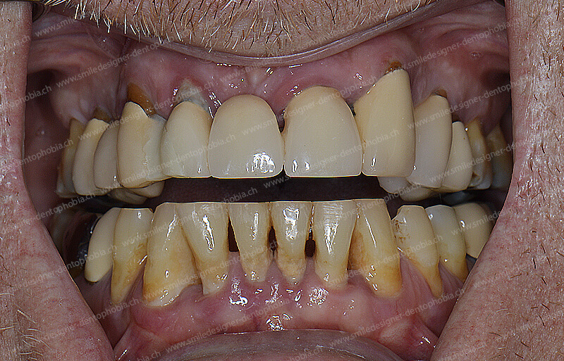 gold-standard-before-2