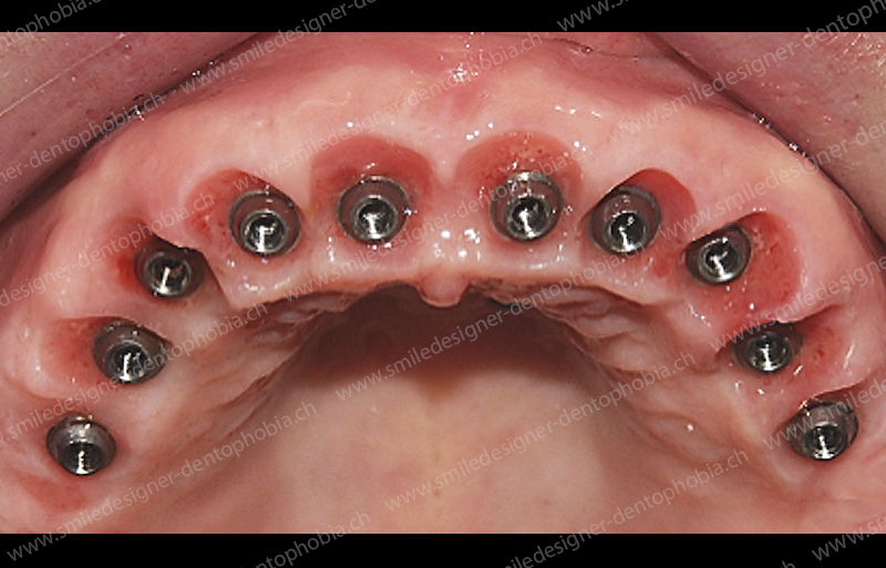 gold-standard-middle-7