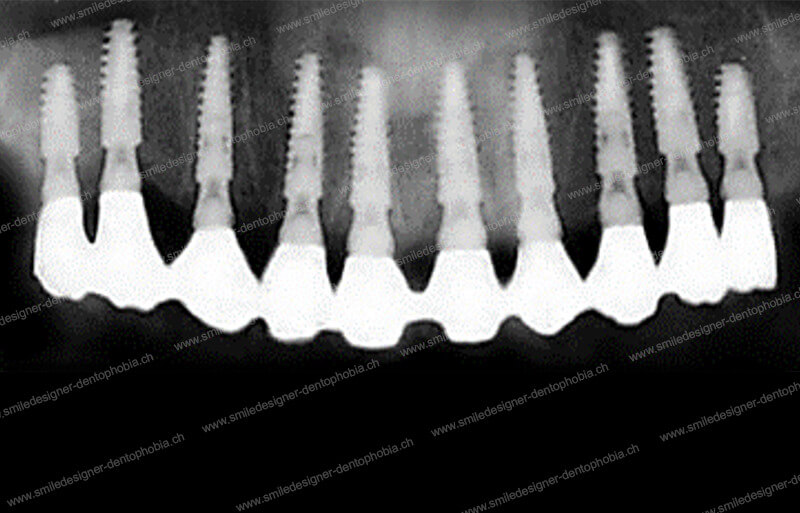 gold-standard-radio-after-1