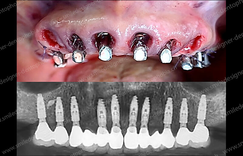 gold-standard-radio-after-5