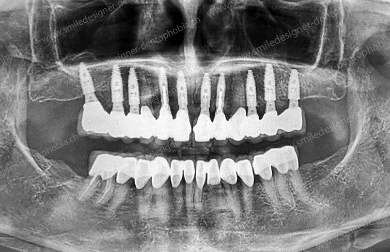 gold-standard-radio-after-6