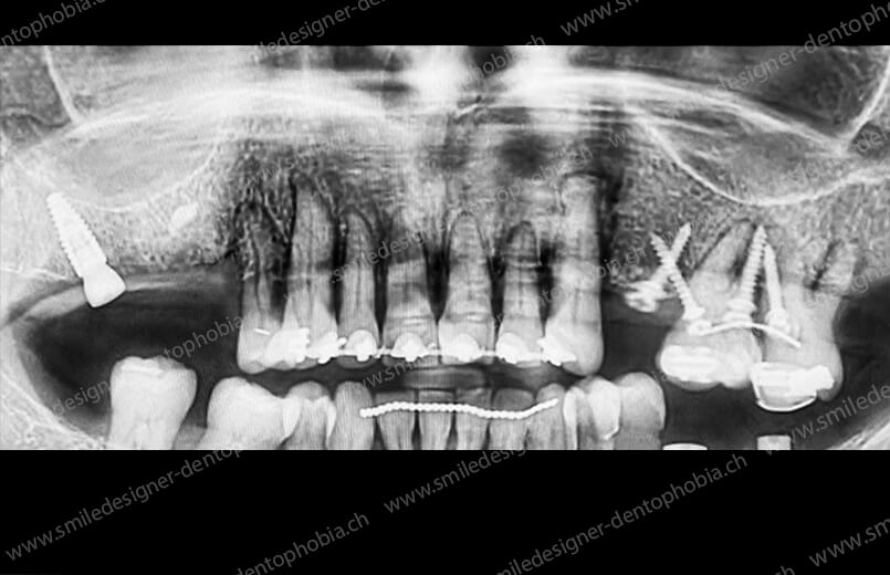 gold-standard-radio-before-5