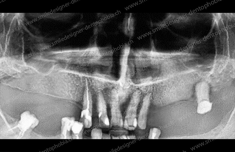 gold-standard-radio-before-7